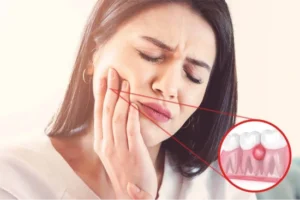 can popping a gum abscess kill you